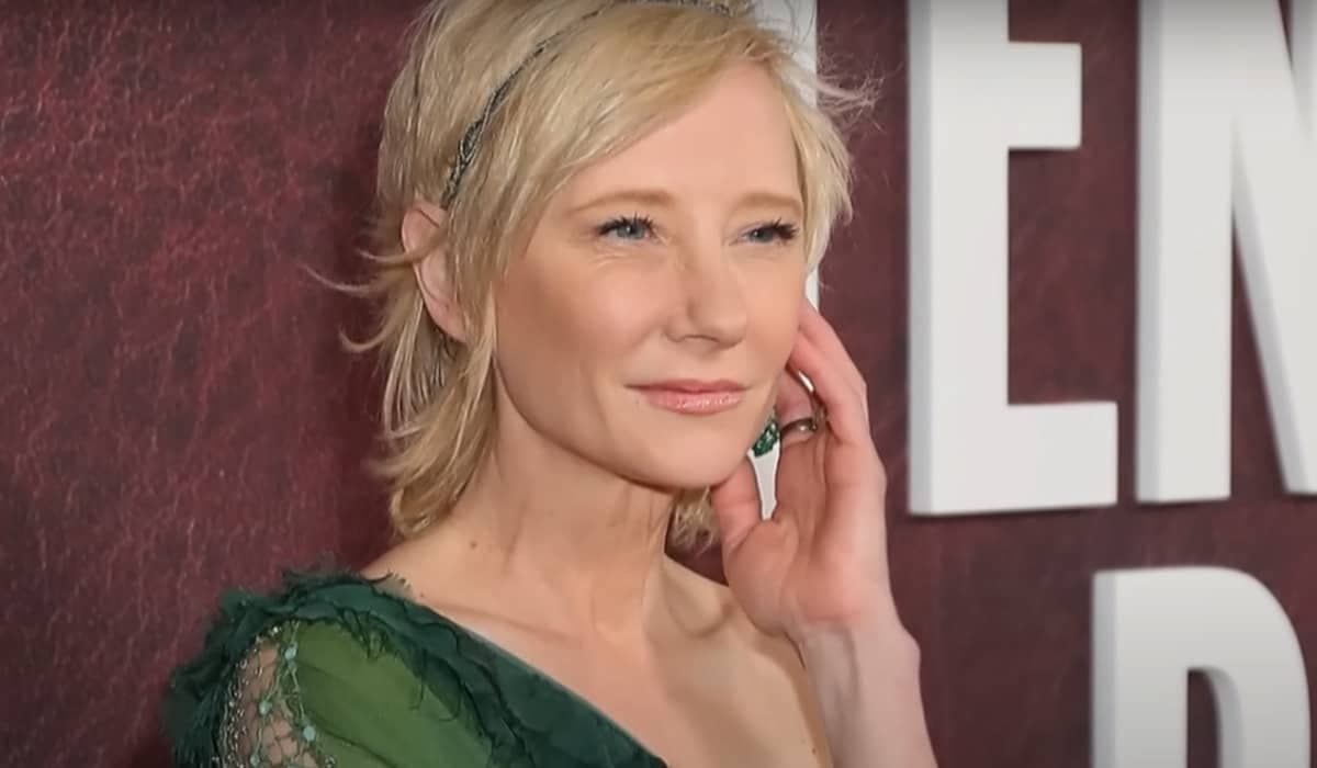 Em coma, atriz Anne Heche vira alvo de investigação criminal
